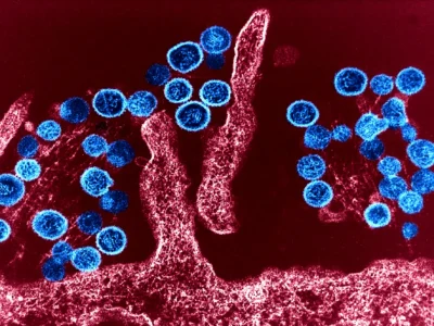Hantavirus, l’OMS rompe il silenzio: “Non è una nuova pandemia”