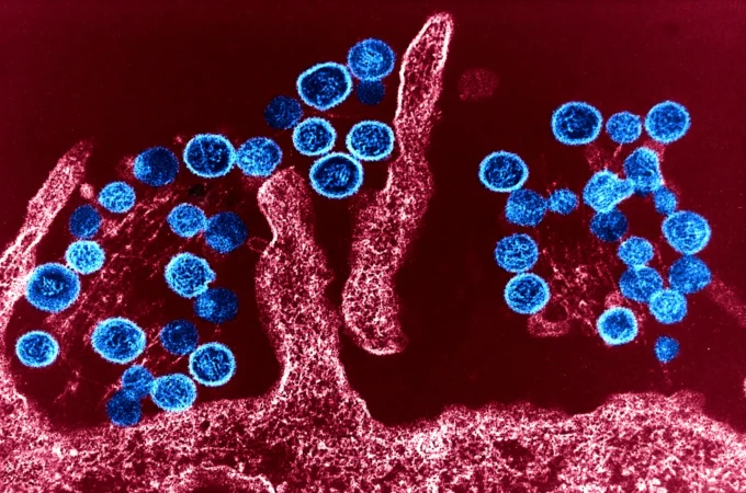 Hantavirus, l’OMS rompe il silenzio: “Non è una nuova pandemia”
