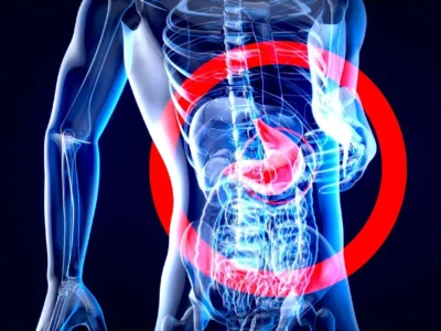 Non è soltanto zucchero: cosa fanno i cibi ultra-processati all’intestino